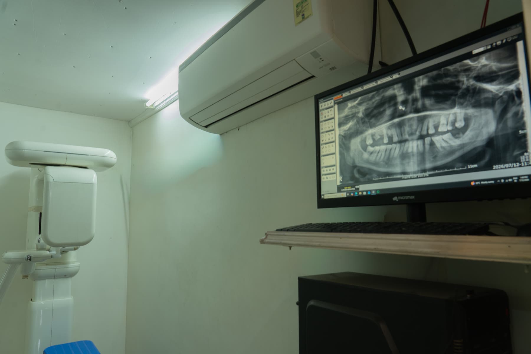 Digital OPG and CBCT imaging room