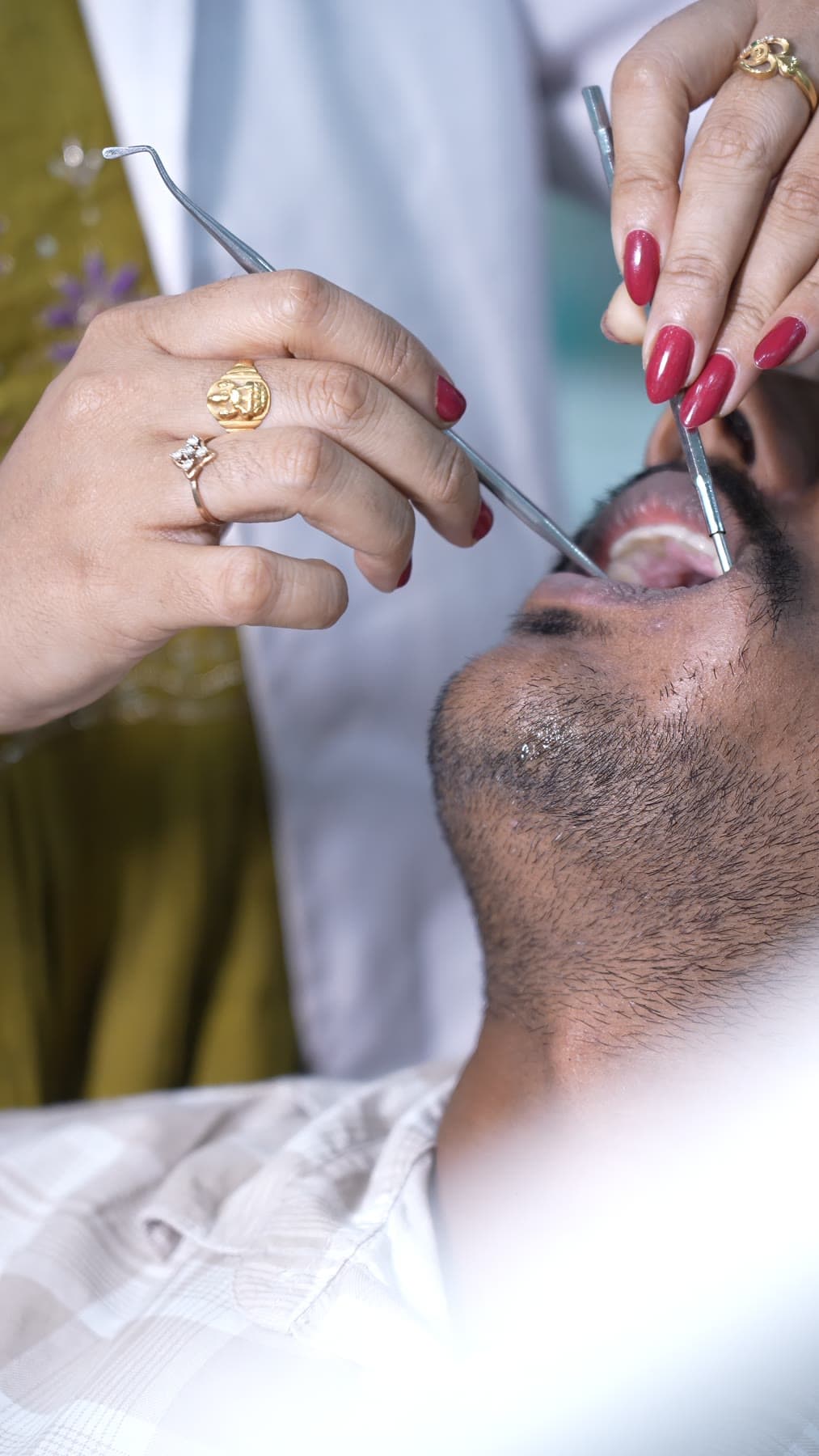 Close-up of a live dental procedure