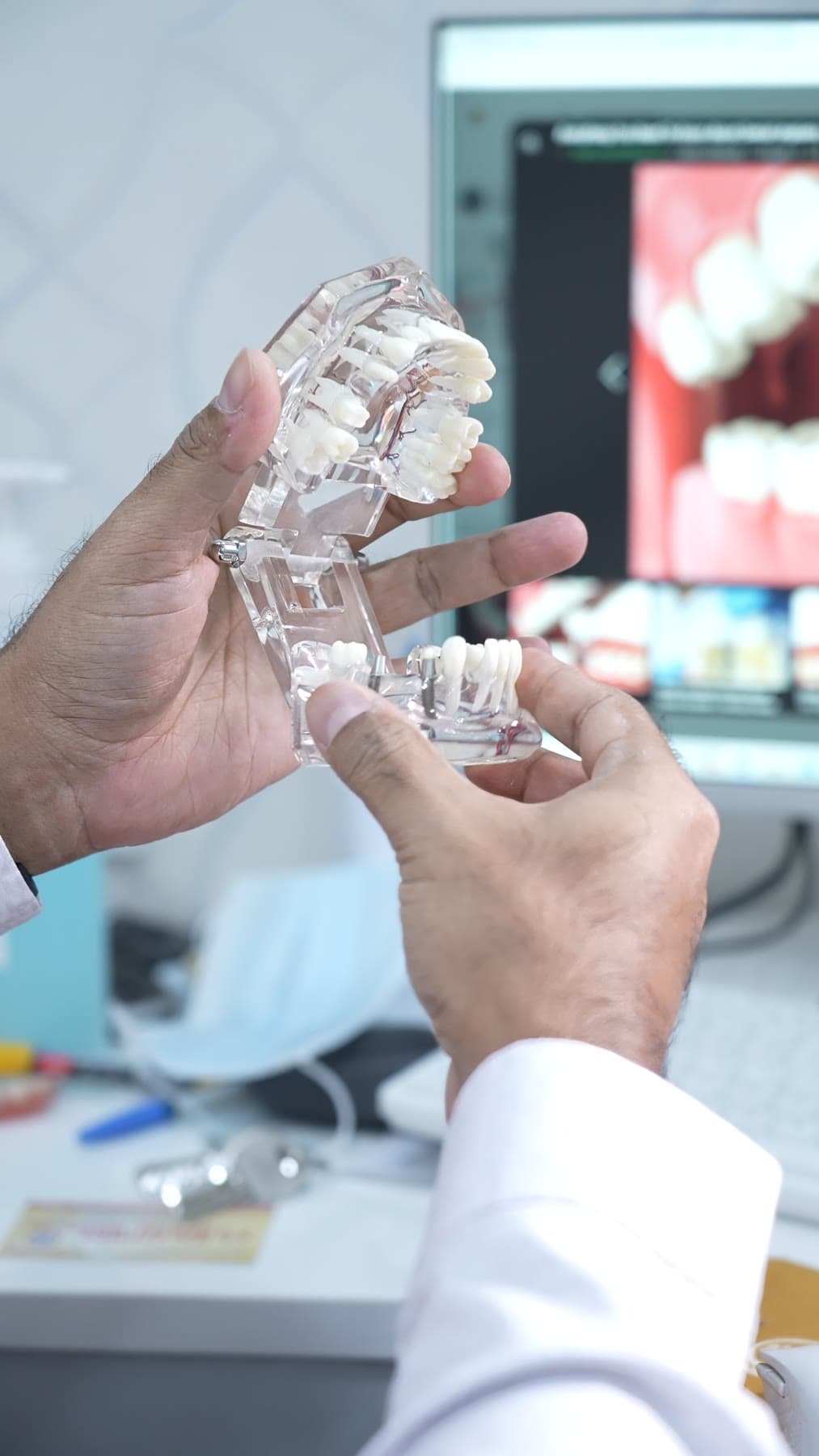 Mentor explaining implant anatomy on a model