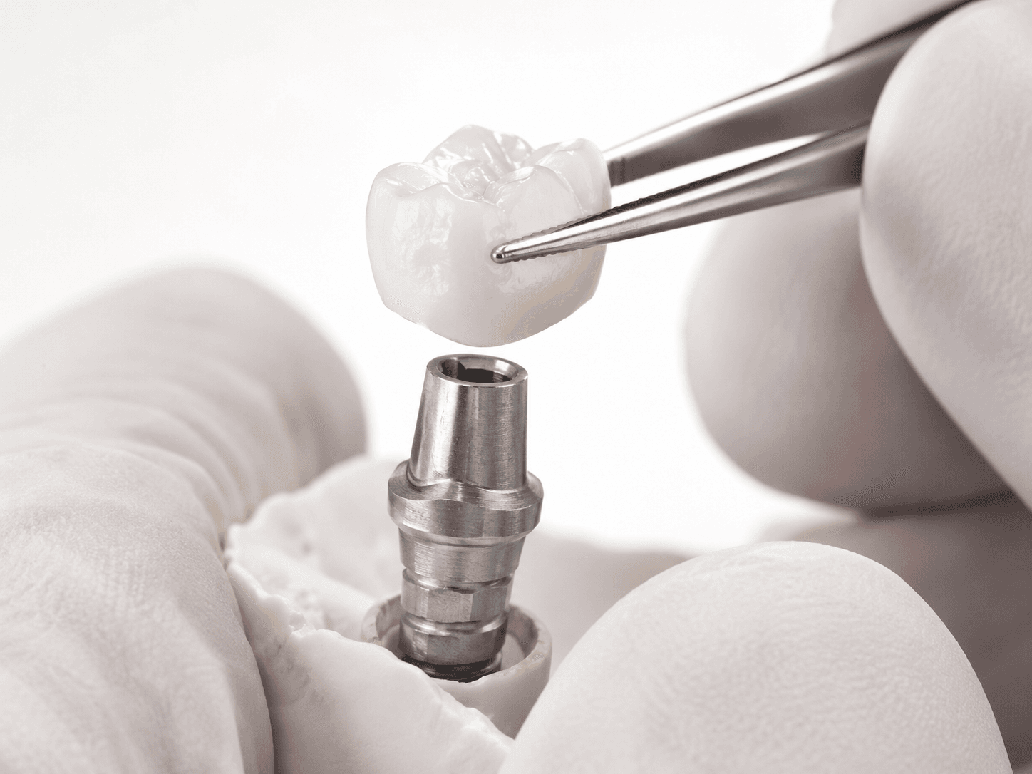 Surgical Fundamentals