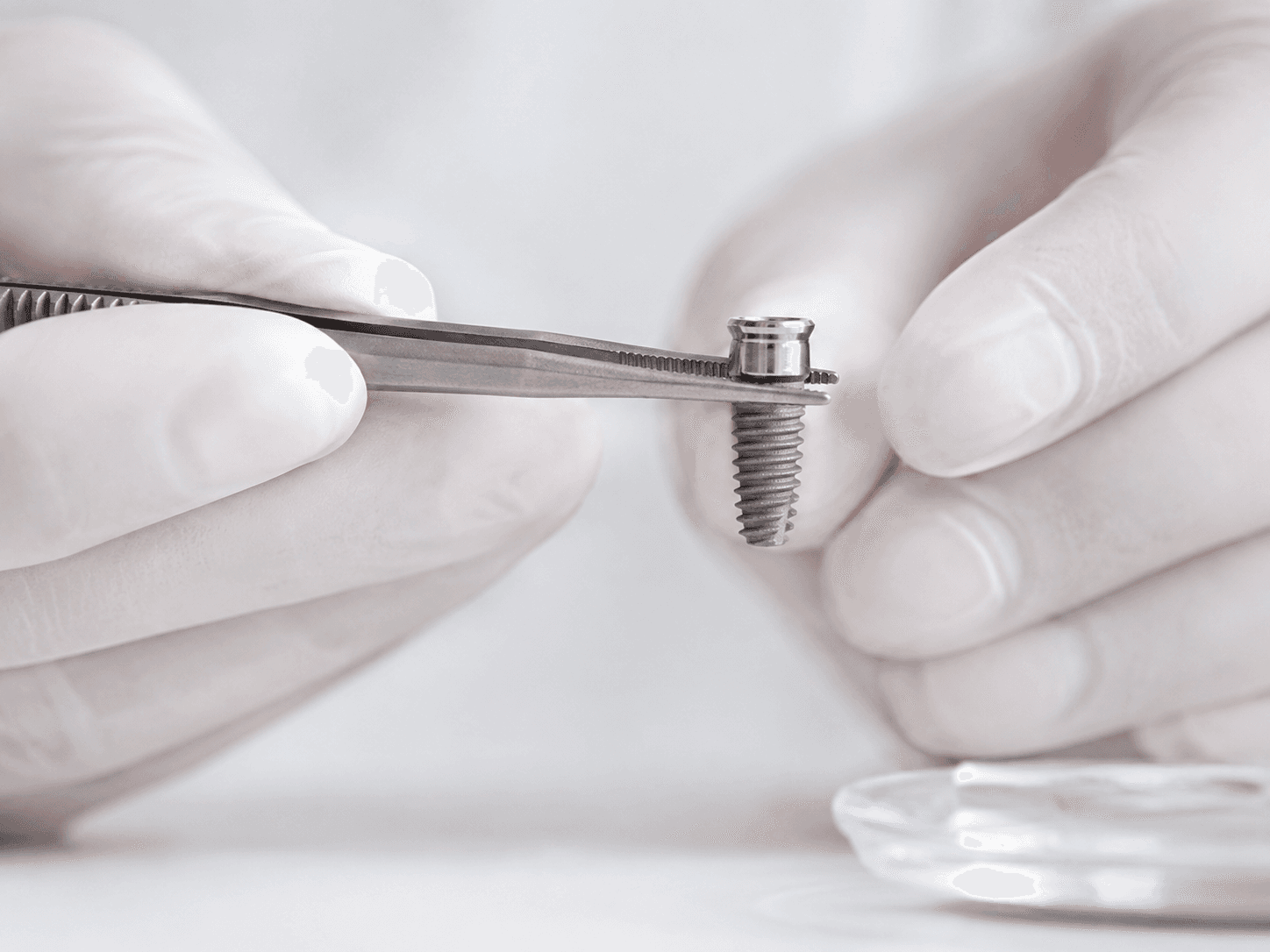 Expert surgeon hands — precision close-up